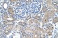 SARDH antibody - middle region